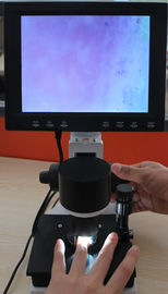 Colora os pixéis capilares do microscópio 380000 do equipamento do Microcirculation do Nailfold com CE